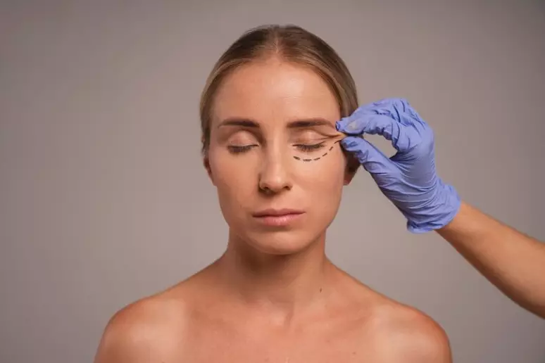 Blefaroplastia - CBS BRASIL