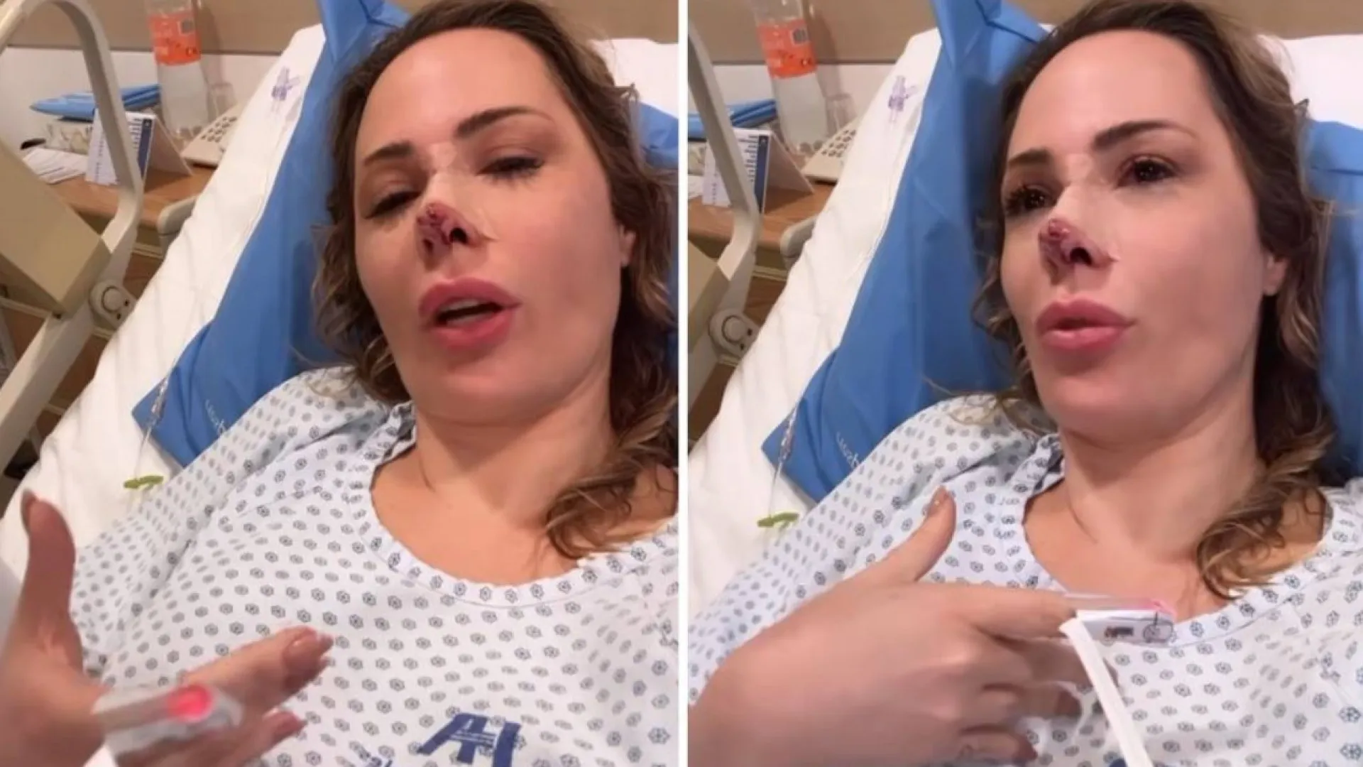 Influenciadora brasileira é atacada por cão no México e passa por cirurgia para reconstruir nariz - img