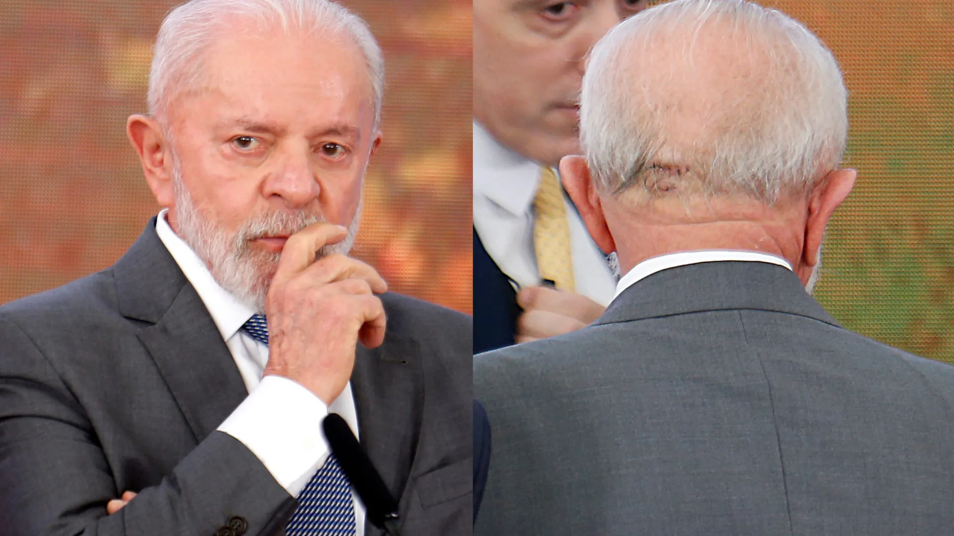 Lula continua na UTI, tirou dreno da cabeça, está lúcido e orientado, diz boletim - img