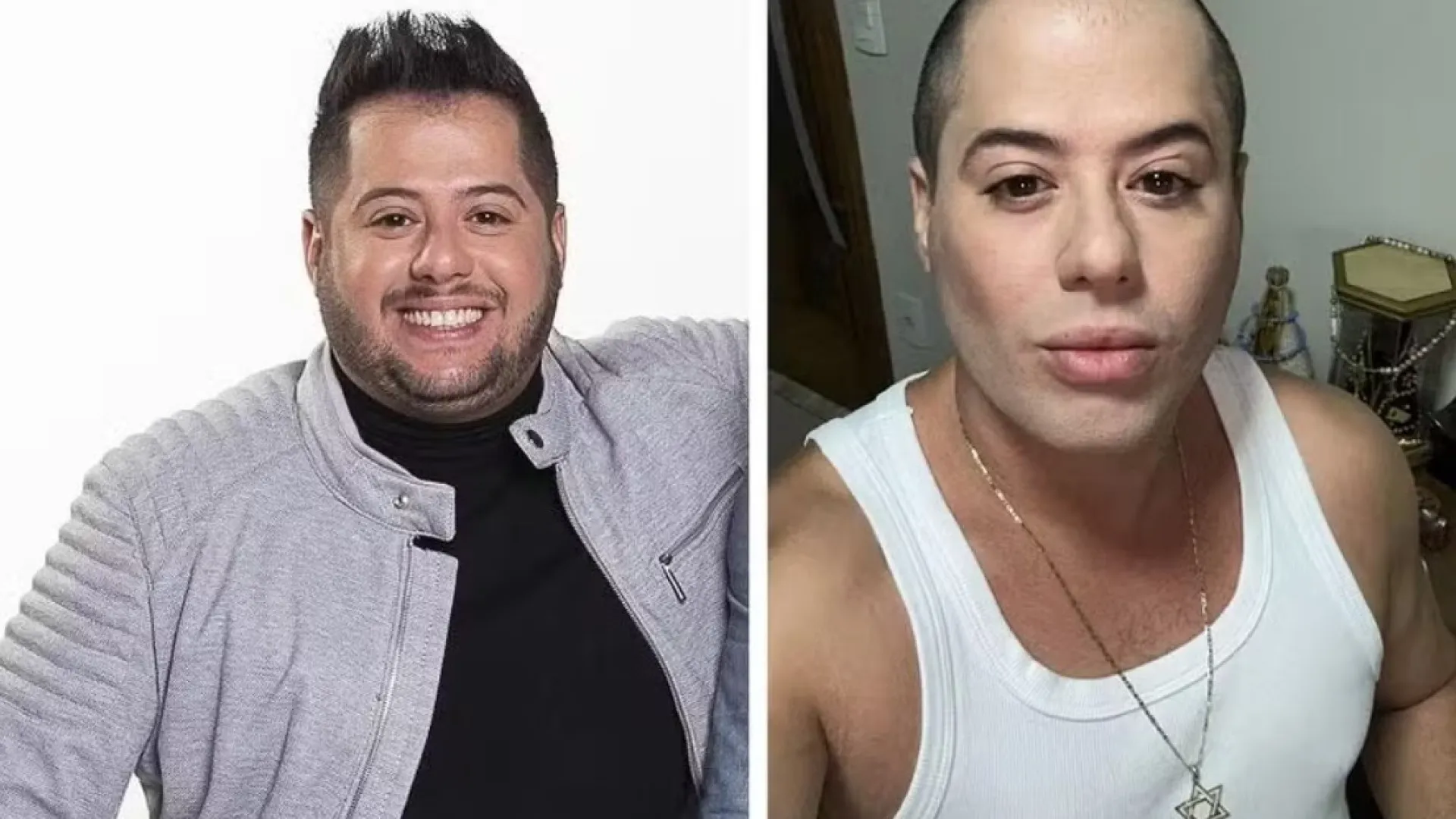 Sertanejo Hugo, da dupla com Tiago, surge bem diferente após harmonização - img