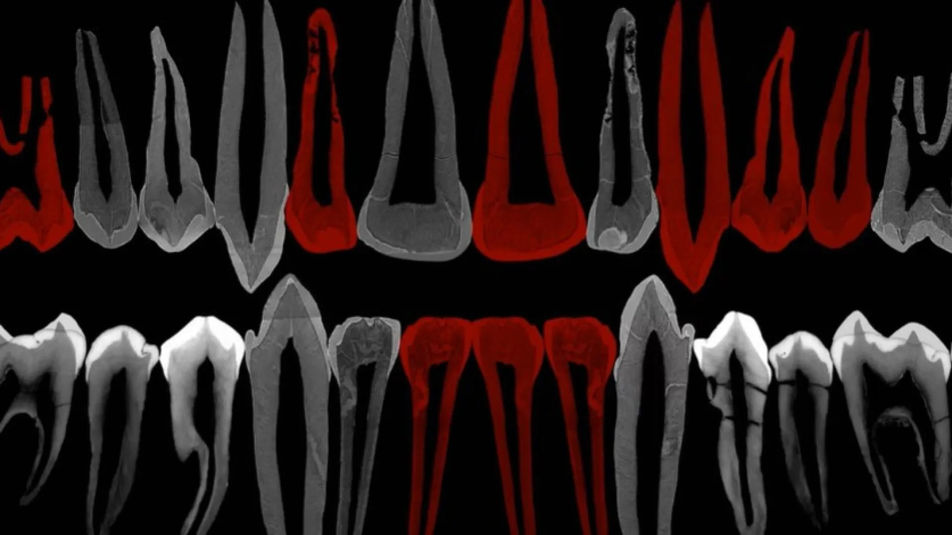 Dentes de adolescente de 1,8 milhão de anos mostram pistas de evolução do crescimento humano - img