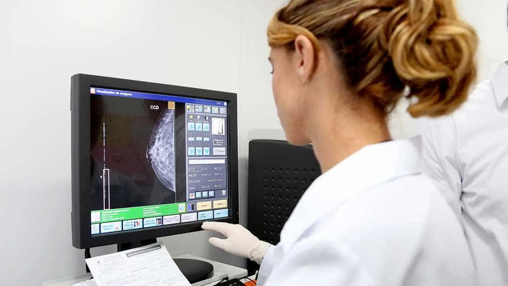 Menopausa precoce acomete mulheres com câncer de mama - img