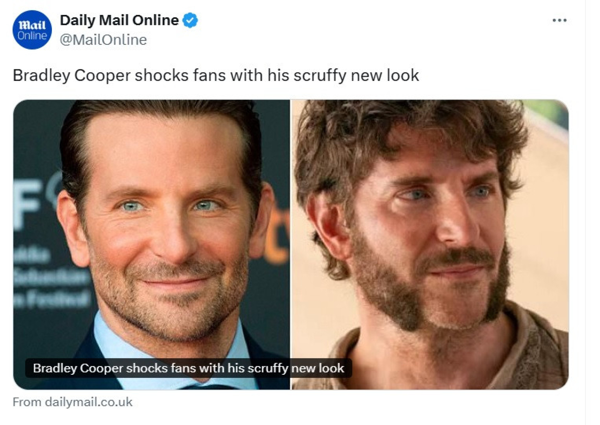 Bradley Cooper chama atenção com visual em nova série 6 Bradley Cooper chama atenção com visual em nova série - img
