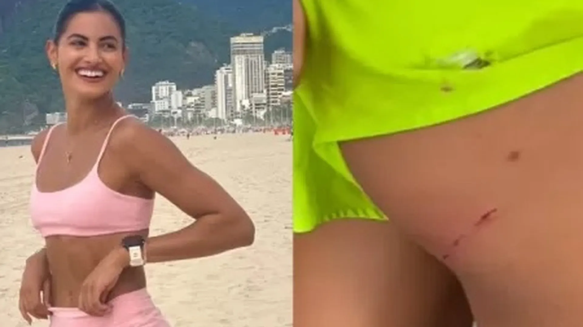 Letícia Salles é atacada por cinco cachorros e leva mordida no bumbum - img