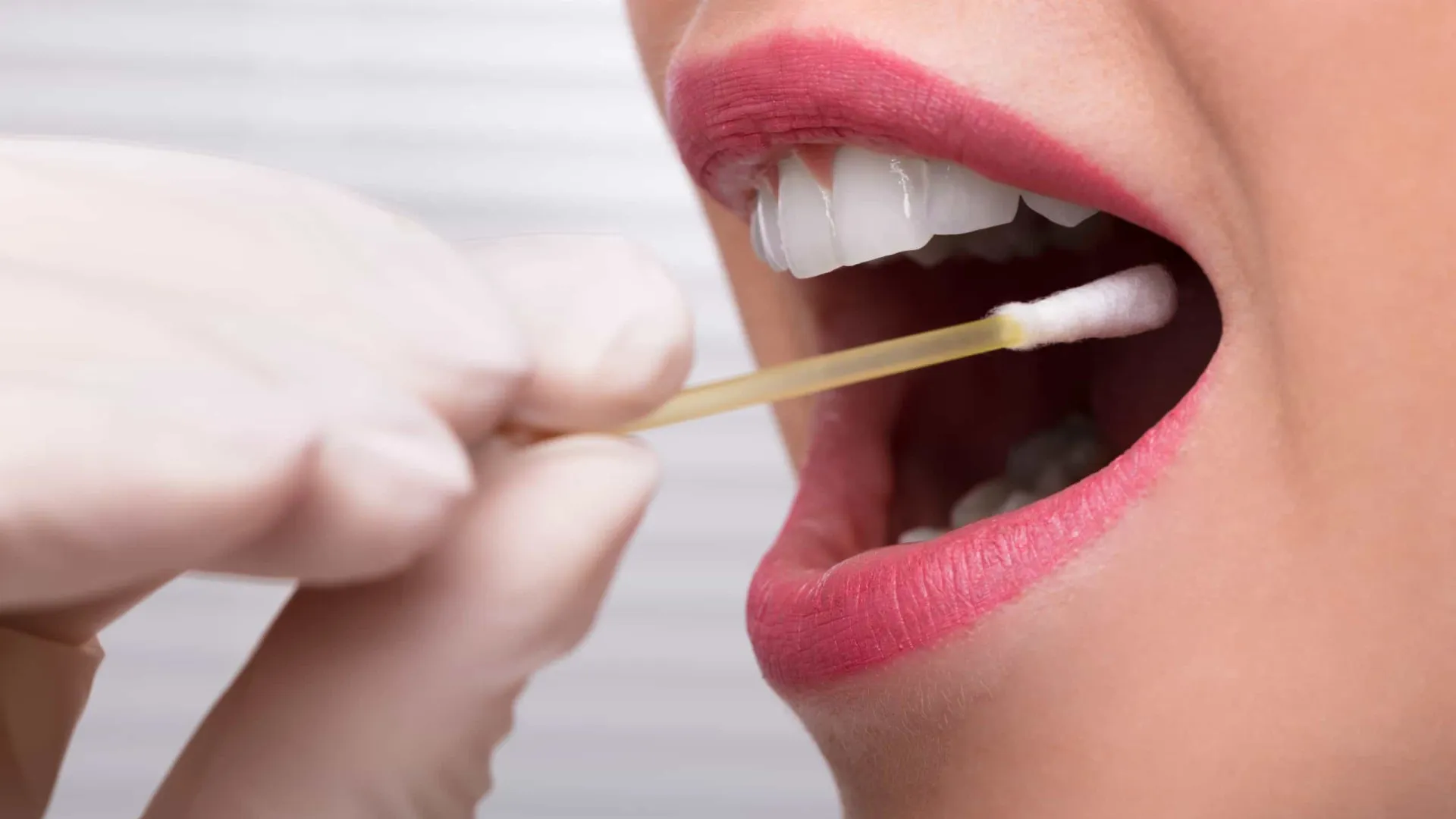 Teste de saliva para endometriose é considerado promissor, mas há ressalvas - img