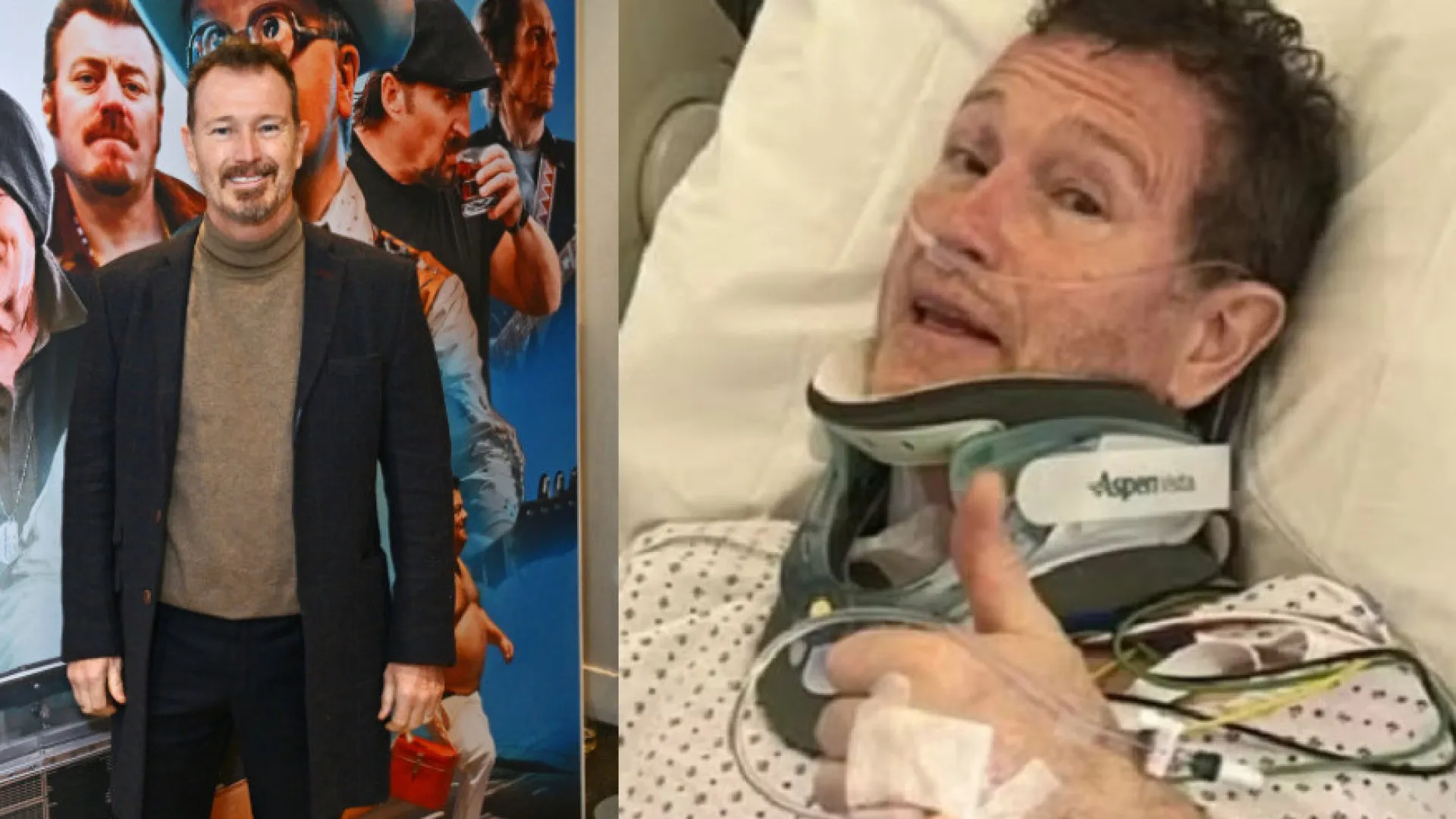 Ator de 'Harry Potter' faz cirurgia de urgência e pode ficar sem andar - img