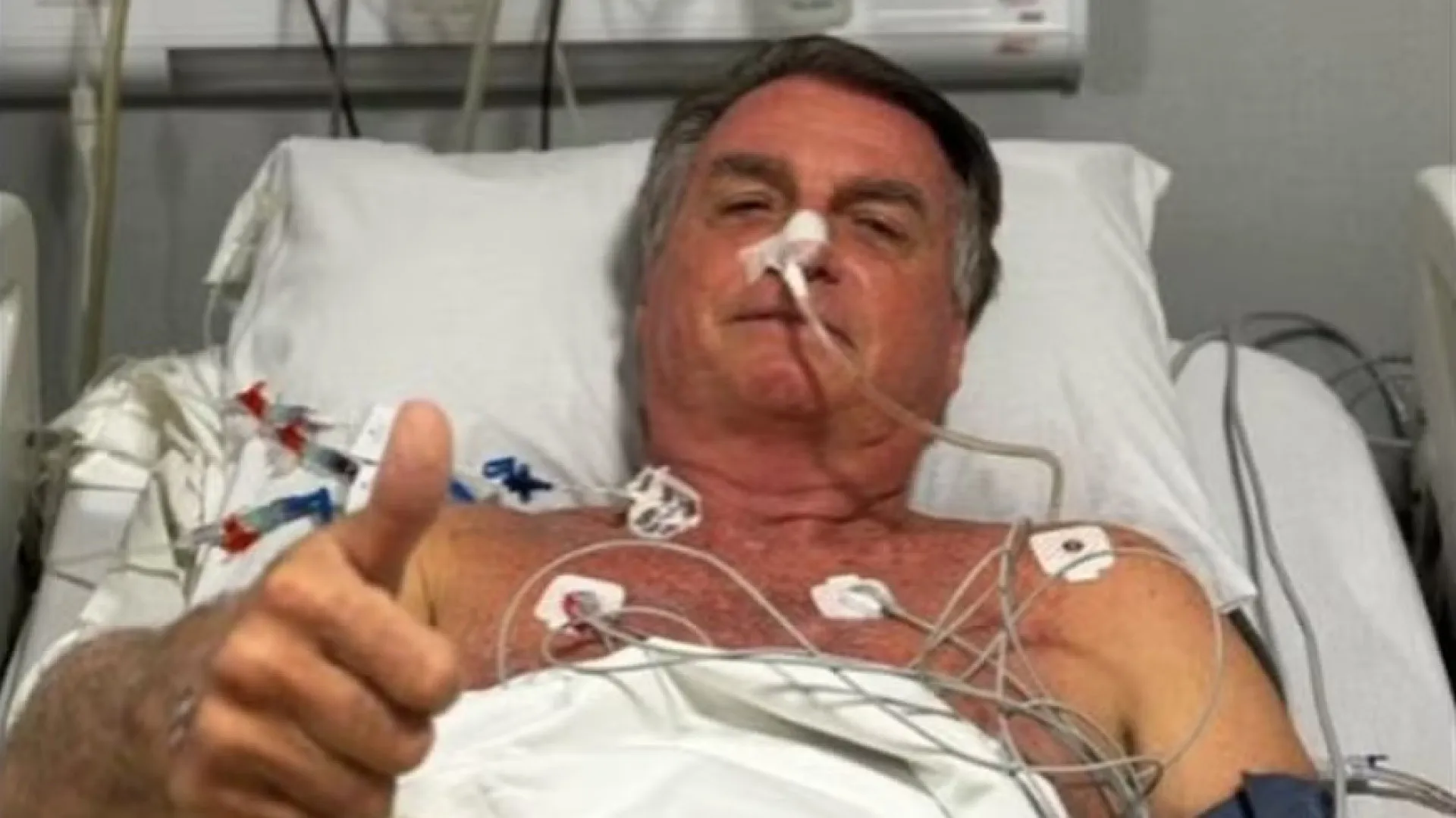Bolsonaro posta e cita complicações no intestino; entenda quadro - img