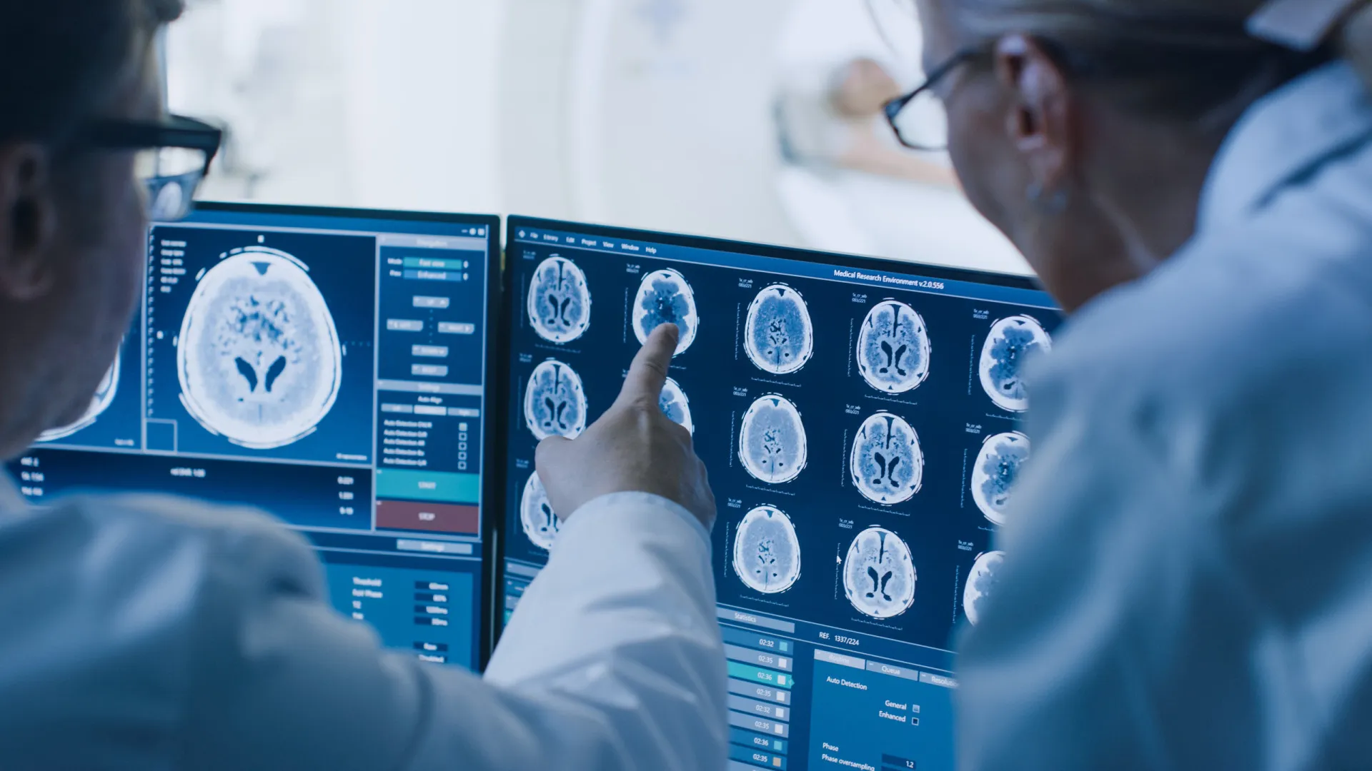 Diabetes pode ter efeito no cérebro semelhante ao do Alzheimer - img