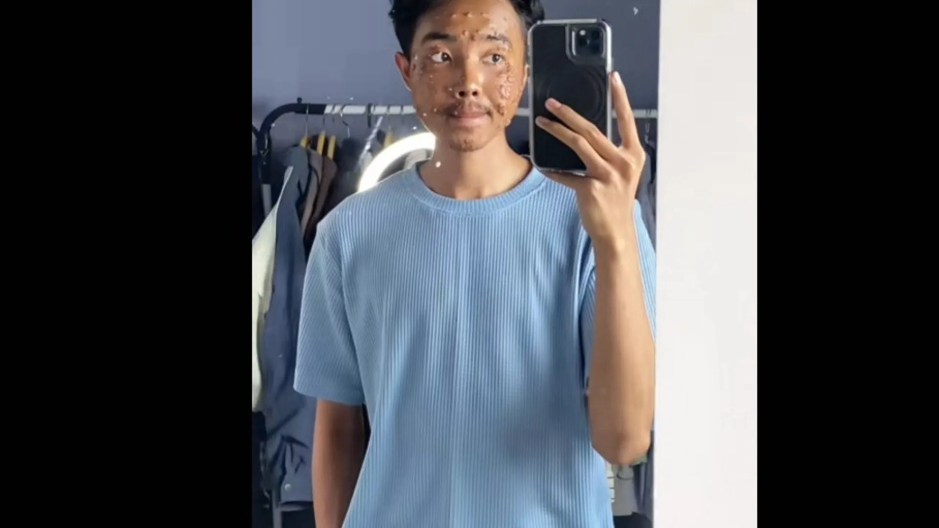 Homem contrai infecção viral após usar roupa de brechó sem lavar - img
