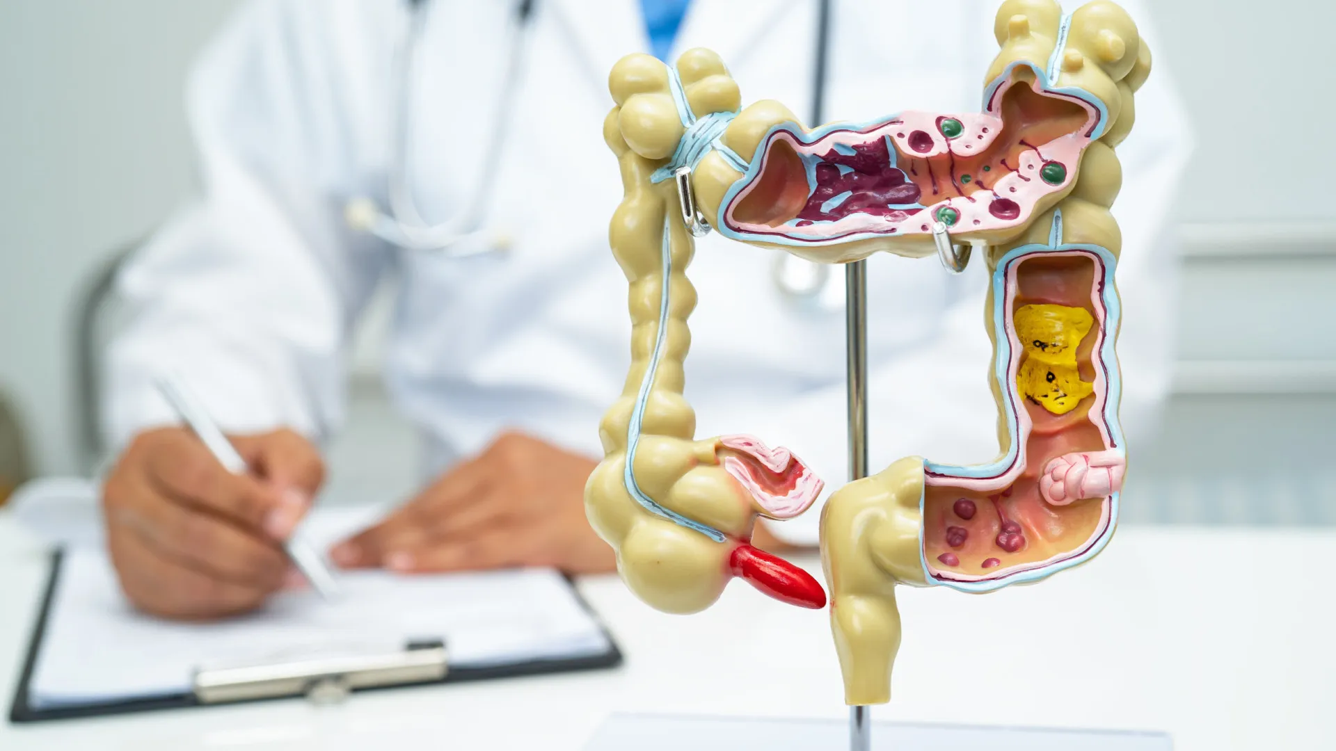 Sete alimentos que podem prejudicar a saúde do seu intestino; entenda - img