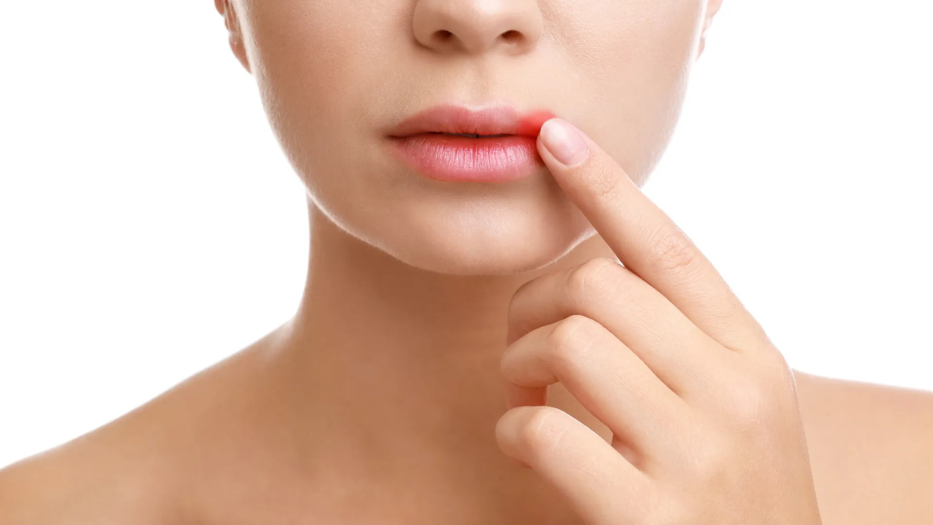 Herpes labial pode aumentar risco de Alzheimer, indica pesquisa - img