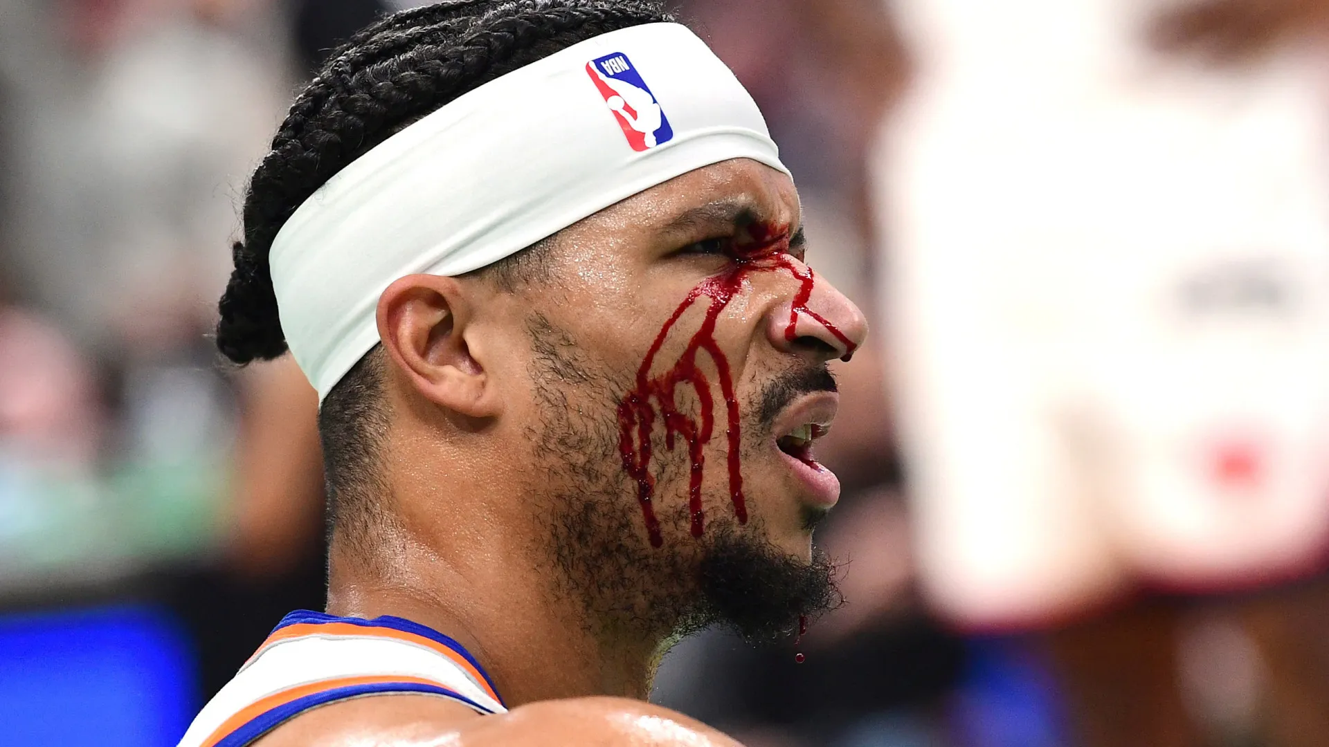 Jogador dos New York Knicks fica sangrando após cotovelada - img