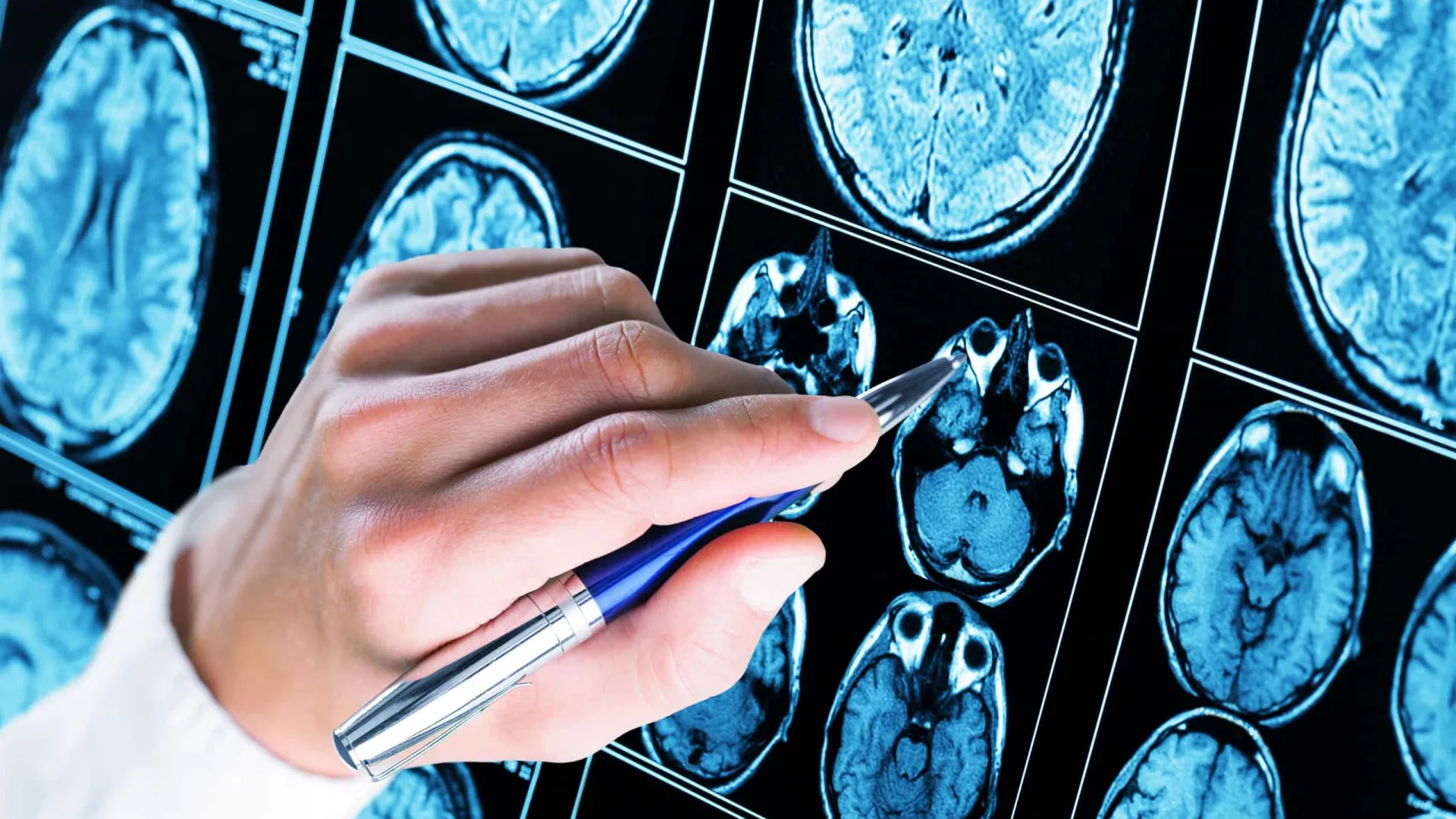 Teste ocular detecta autismo em bebês com 80% de precisão - img