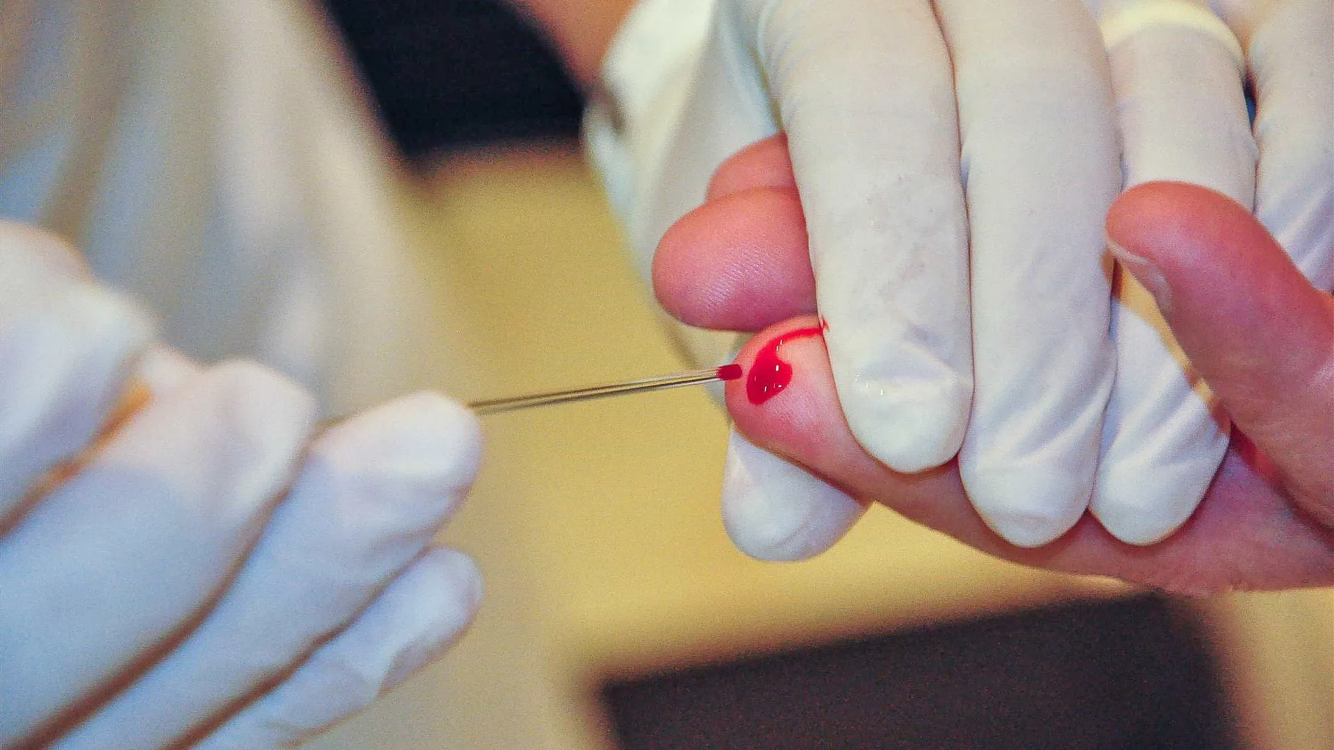 Hepatites virais causam mais de mil mortes em 2024 no Brasil - img
