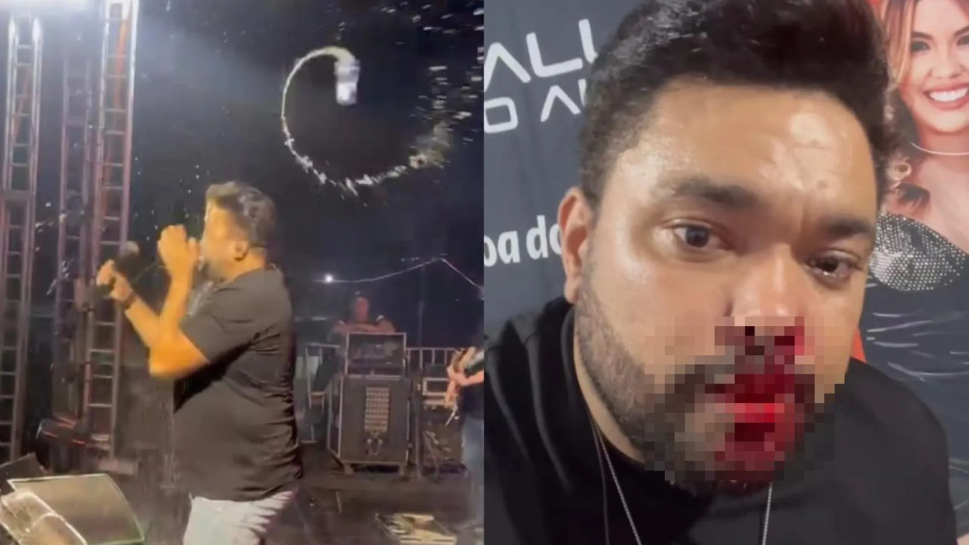 Cantor é atingido por lata no rosto e sai do show sangrando em MT - img