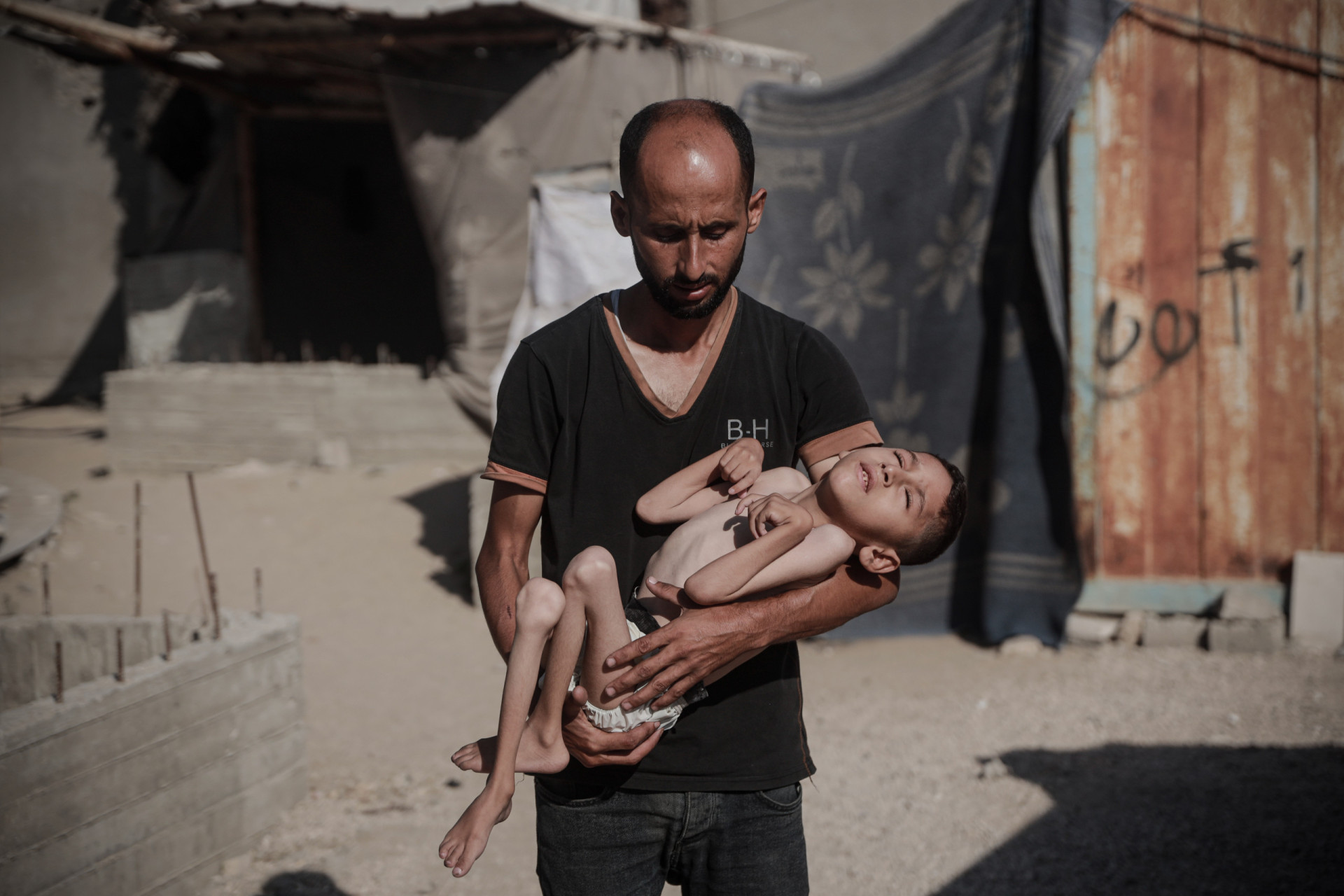 É impossível negar: a fome em Gaza é real e devastadora; veja as imagens - img