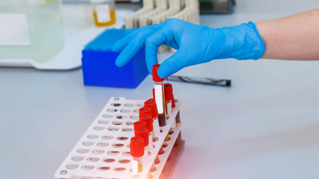 Vacina contra herpes-zóster pode reduzir risco de infarto e AVC, diz estudo - img