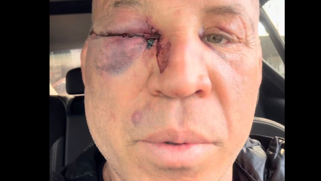 Wanderlei Silva diz que vai à Justiça após pancadaria em luta contra Popó - img