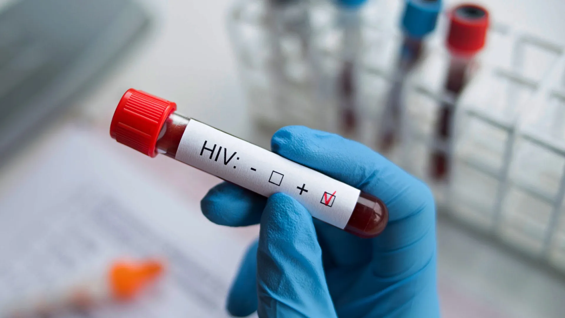 Progresso em pesquisas do HIV: Estamos perto da cura? - img