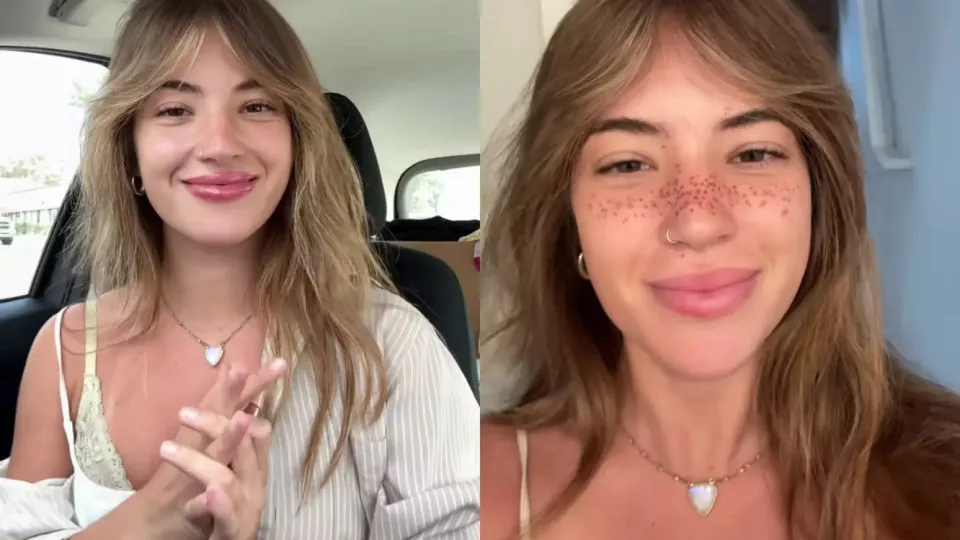 Influencer viraliza ao tatuar sardas no rosto e rebate críticas na web - img