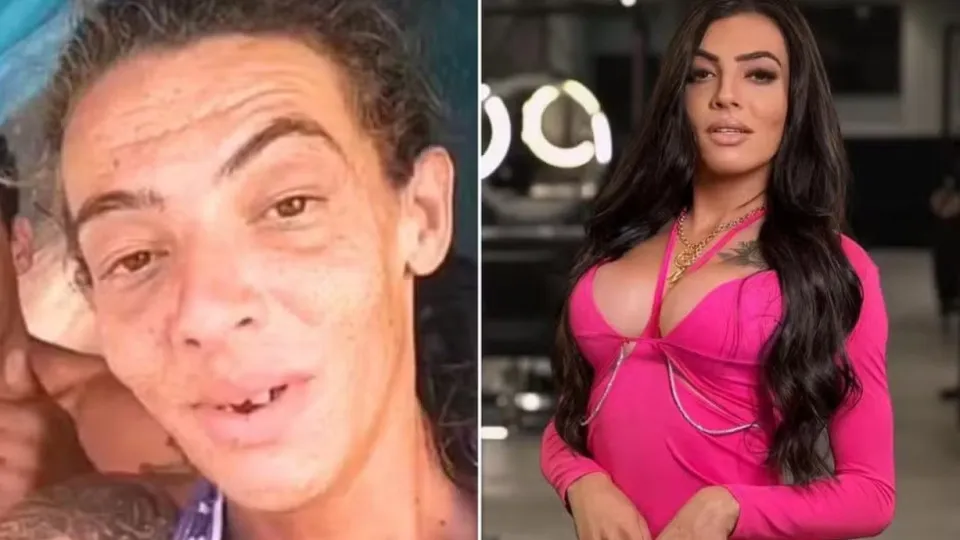 Influenciadora que viveu nas ruas faz 10ª cirurgia e impressiona - img