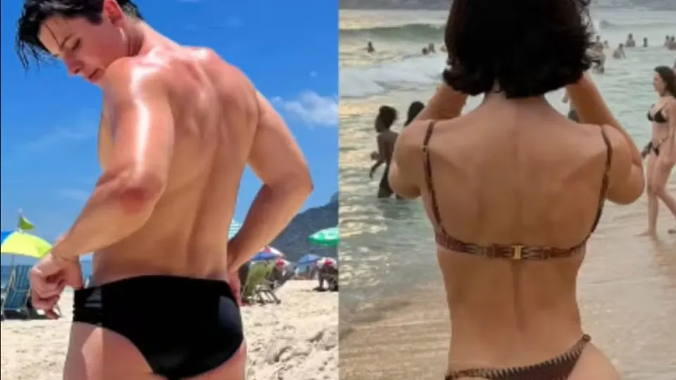 Bella Longuinho mostra antes e depois de procedimento nos glúteos; veja - img