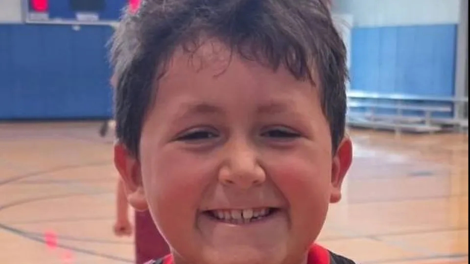 Menino faz desafio do TikTok e acaba com rosto desfigurado - img