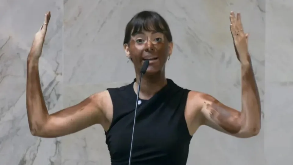 Deputada Fabiana Bolsonaro faz 'blackface' em protesto transfóbico - img