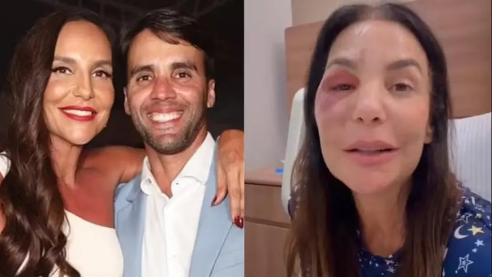 Ex-marido de Ivete fala sobre a cirurgia da cantora: 'Mulher de aço' - img