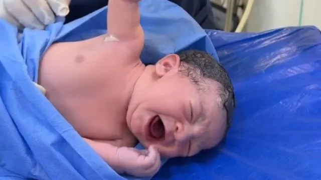 Recém-nascido não larga médico e momento viraliza; veja o momento! - img