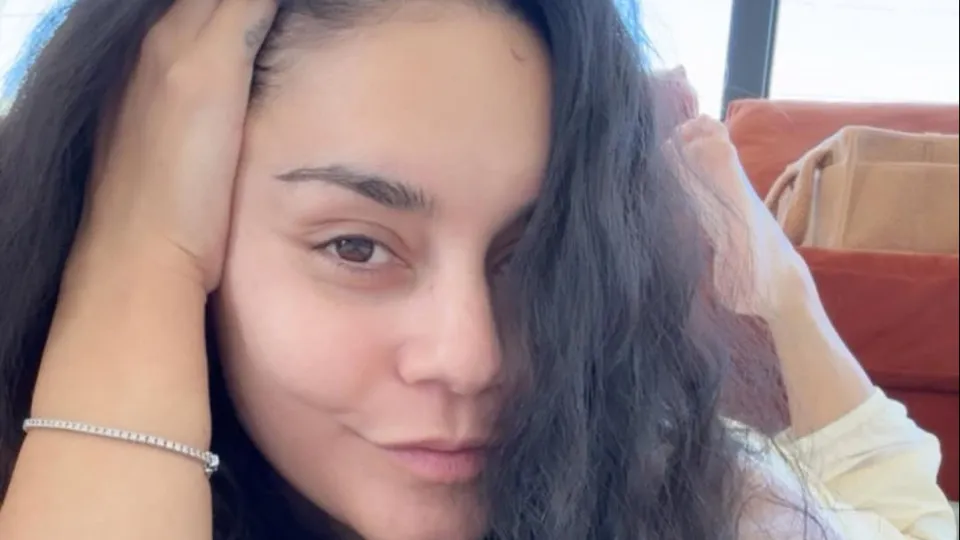 Vanessa Hudgens mostra queda de cabelo pós-parto - img
